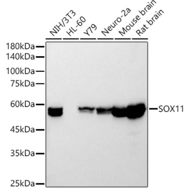 Western Blot - Anti-SOX11 Antibody [ARC54700] (A307984) - Antibodies.com