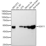 Western Blot - Anti-SOX11 Antibody [ARC54700] (A307984) - Antibodies.com