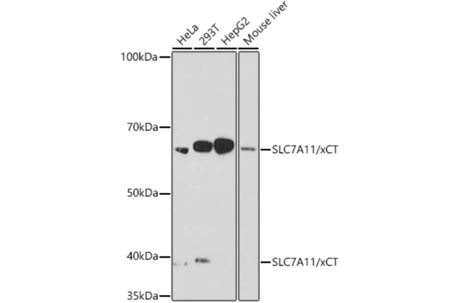 Western Blot - Anti-xCT Antibody [ARC0753] (A307985) - Antibodies.com
