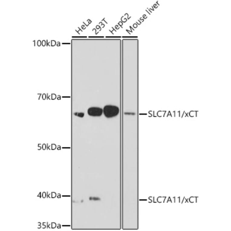 Western Blot - Anti-xCT Antibody [ARC0753] (A307985) - Antibodies.com