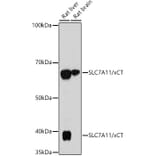 Western Blot - Anti-xCT Antibody [ARC0753] (A307985) - Antibodies.com