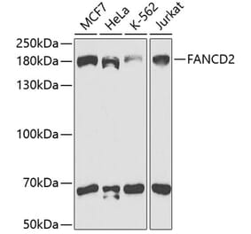 Western Blot - Anti-FANCD2 Antibody (A307987) - Antibodies.com