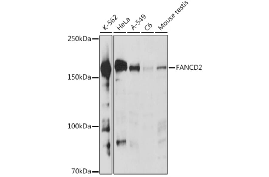 Western Blot - Anti-FANCD2 Antibody (A307988) - Antibodies.com