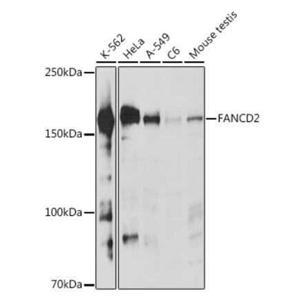 Western Blot - Anti-FANCD2 Antibody (A307988) - Antibodies.com