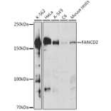 Western Blot - Anti-FANCD2 Antibody (A307988) - Antibodies.com
