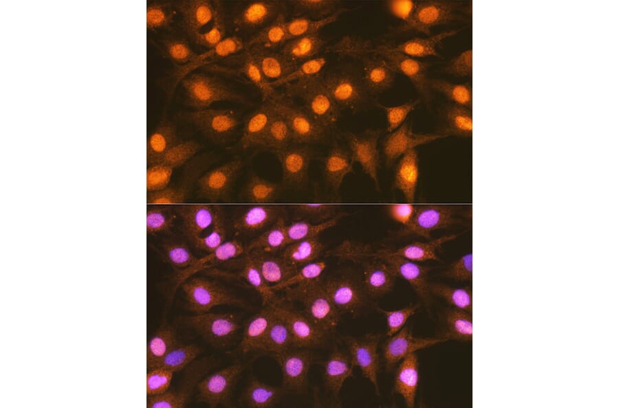 Immunofluorescence - Anti-FANCD2 Antibody (A307988) - Antibodies.com
