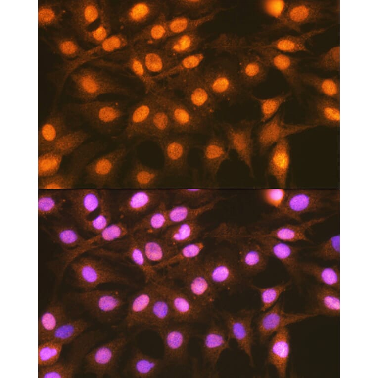 Immunofluorescence - Anti-FANCD2 Antibody (A307988) - Antibodies.com