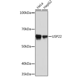 Western Blot - Anti-USP22 Antibody [ARC1498] (A307989) - Antibodies.com