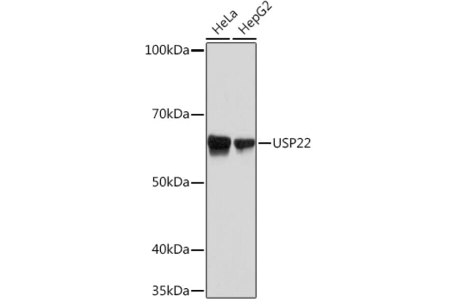 Western Blot - Anti-USP22 Antibody [ARC1498] (A307989) - Antibodies.com
