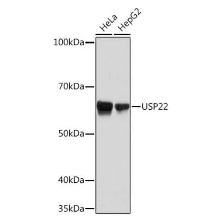 Western Blot - Anti-USP22 Antibody [ARC1498] (A307989) - Antibodies.com