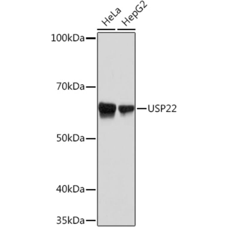 Western Blot - Anti-USP22 Antibody [ARC1498] (A307989) - Antibodies.com