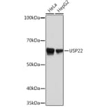 Western Blot - Anti-USP22 Antibody [ARC1498] (A307989) - Antibodies.com