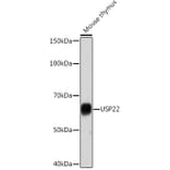 Western Blot - Anti-USP22 Antibody [ARC1498] (A307989) - Antibodies.com
