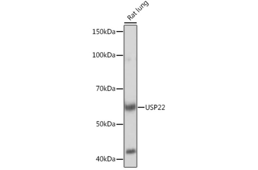 Western Blot - Anti-USP22 Antibody [ARC1498] (A307989) - Antibodies.com
