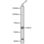 Western Blot - Anti-USP22 Antibody [ARC1498] (A307989) - Antibodies.com
