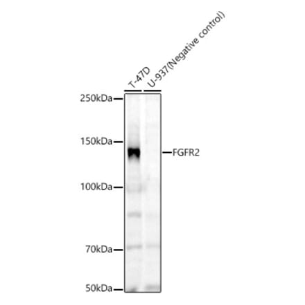 Western Blot - Anti-FGFR2 Antibody [ARC60257] (A307990) - Antibodies.com