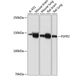 Western Blot - Anti-FGFR2 Antibody [ARC0480] (A307991) - Antibodies.com