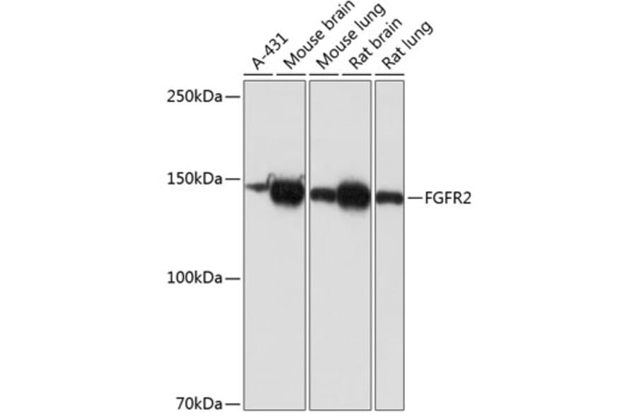 Western Blot - Anti-FGFR2 Antibody [ARC0480] (A307991) - Antibodies.com