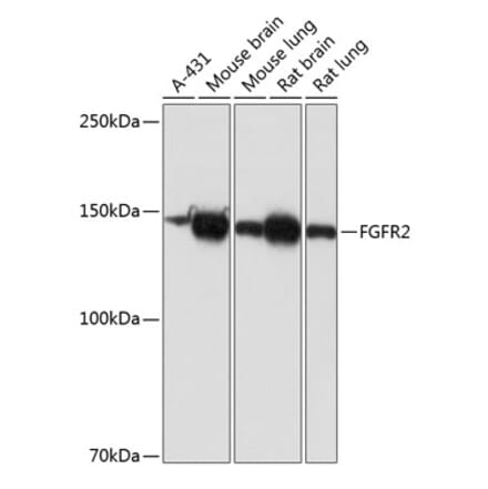Western Blot - Anti-FGFR2 Antibody [ARC0480] (A307991) - Antibodies.com