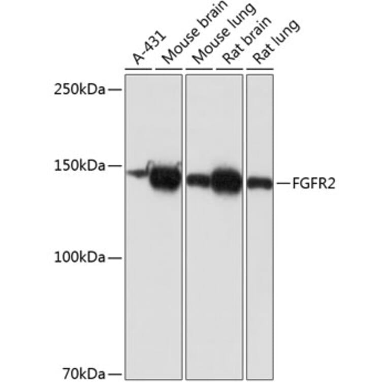 Western Blot - Anti-FGFR2 Antibody [ARC0480] (A307991) - Antibodies.com
