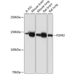 Western Blot - Anti-FGFR2 Antibody [ARC0480] (A307991) - Antibodies.com