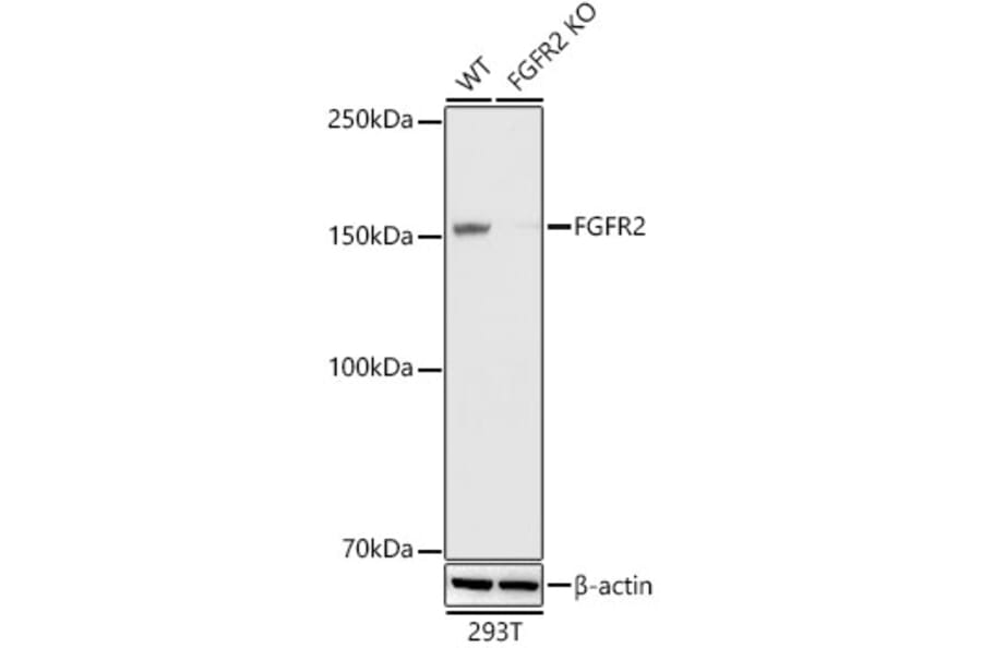 Western Blot - Anti-FGFR2 Antibody [ARC0480] (A307991) - Antibodies.com