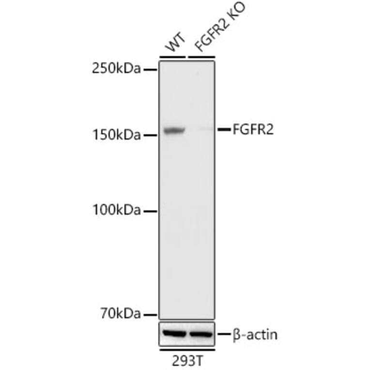 Western Blot - Anti-FGFR2 Antibody [ARC0480] (A307991) - Antibodies.com
