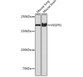 Western Blot - Anti-VEGF Receptor 1 Antibody [ARC0363] (A307992) - Antibodies.com