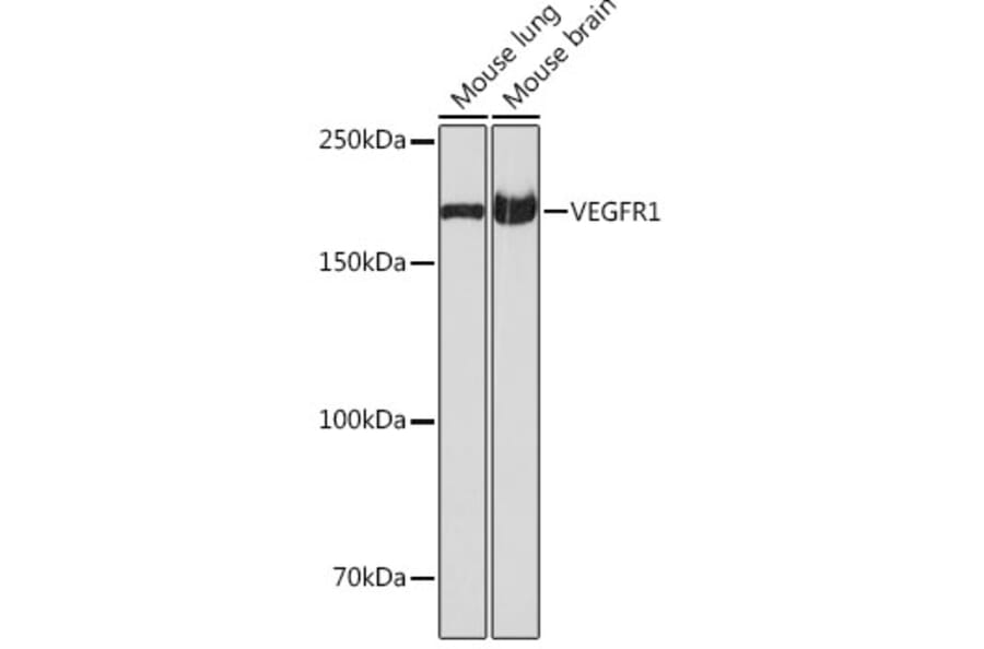 Western Blot - Anti-VEGF Receptor 1 Antibody [ARC0363] (A307992) - Antibodies.com