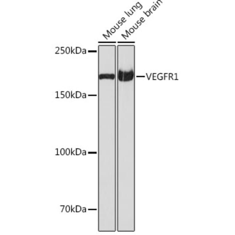 Western Blot - Anti-VEGF Receptor 1 Antibody [ARC0363] (A307992) - Antibodies.com