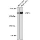 Western Blot - Anti-VEGF Receptor 1 Antibody [ARC0363] (A307992) - Antibodies.com