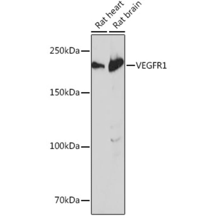 Western Blot - Anti-VEGF Receptor 1 Antibody [ARC0363] (A307992) - Antibodies.com