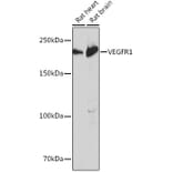 Western Blot - Anti-VEGF Receptor 1 Antibody [ARC0363] (A307992) - Antibodies.com