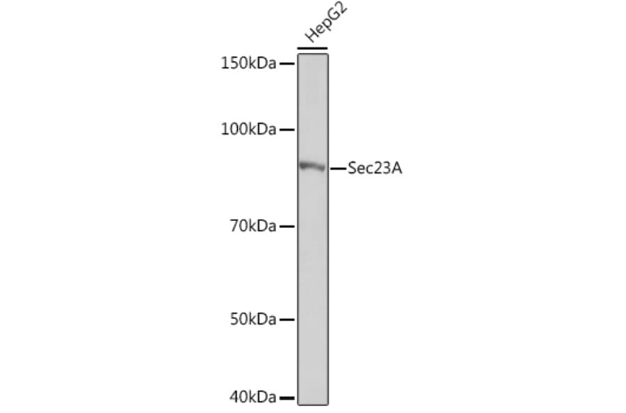 Western Blot - Anti-SEC23A Antibody [ARC1754] (A307993) - Antibodies.com