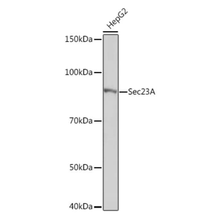 Western Blot - Anti-SEC23A Antibody [ARC1754] (A307993) - Antibodies.com