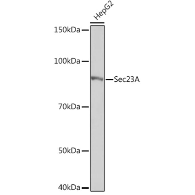Western Blot - Anti-SEC23A Antibody [ARC1754] (A307993) - Antibodies.com