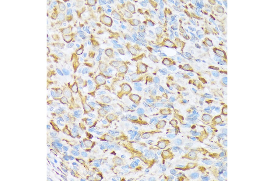 Immunohistochemistry - Anti-SEC23A Antibody [ARC1754] (A307993) - Antibodies.com