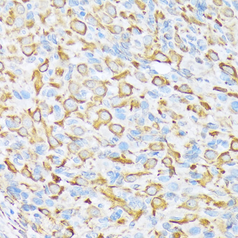 Immunohistochemistry - Anti-SEC23A Antibody [ARC1754] (A307993) - Antibodies.com