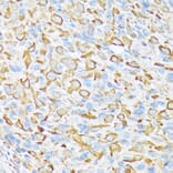 Immunohistochemistry - Anti-SEC23A Antibody [ARC1754] (A307993) - Antibodies.com