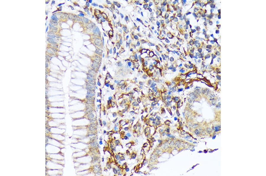 Immunohistochemistry - Anti-SEC23A Antibody [ARC1754] (A307993) - Antibodies.com