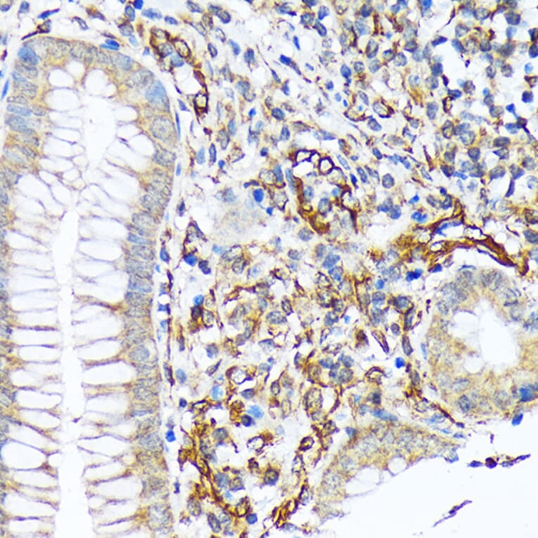 Immunohistochemistry - Anti-SEC23A Antibody [ARC1754] (A307993) - Antibodies.com