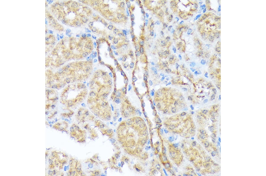 Immunohistochemistry - Anti-SEC23A Antibody [ARC1754] (A307993) - Antibodies.com