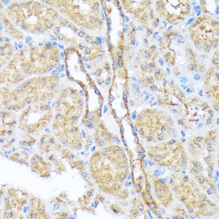 Immunohistochemistry - Anti-SEC23A Antibody [ARC1754] (A307993) - Antibodies.com