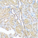 Immunohistochemistry - Anti-SEC23A Antibody [ARC1754] (A307993) - Antibodies.com