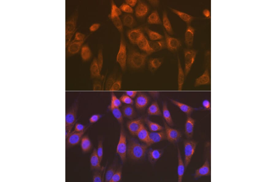 Immunofluorescence - Anti-SEC23A Antibody [ARC1754] (A307993) - Antibodies.com