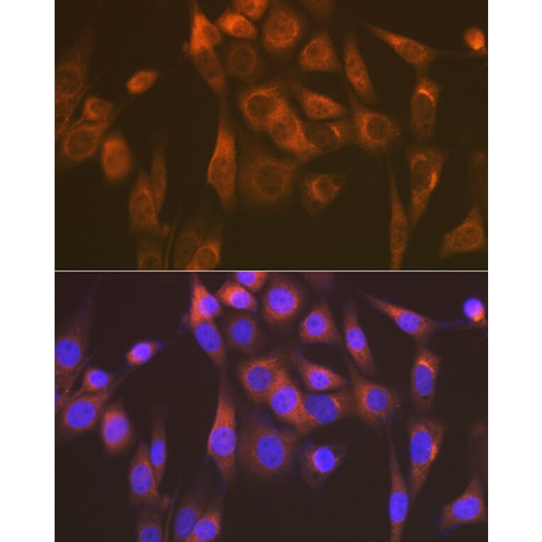 Immunofluorescence - Anti-SEC23A Antibody [ARC1754] (A307993) - Antibodies.com