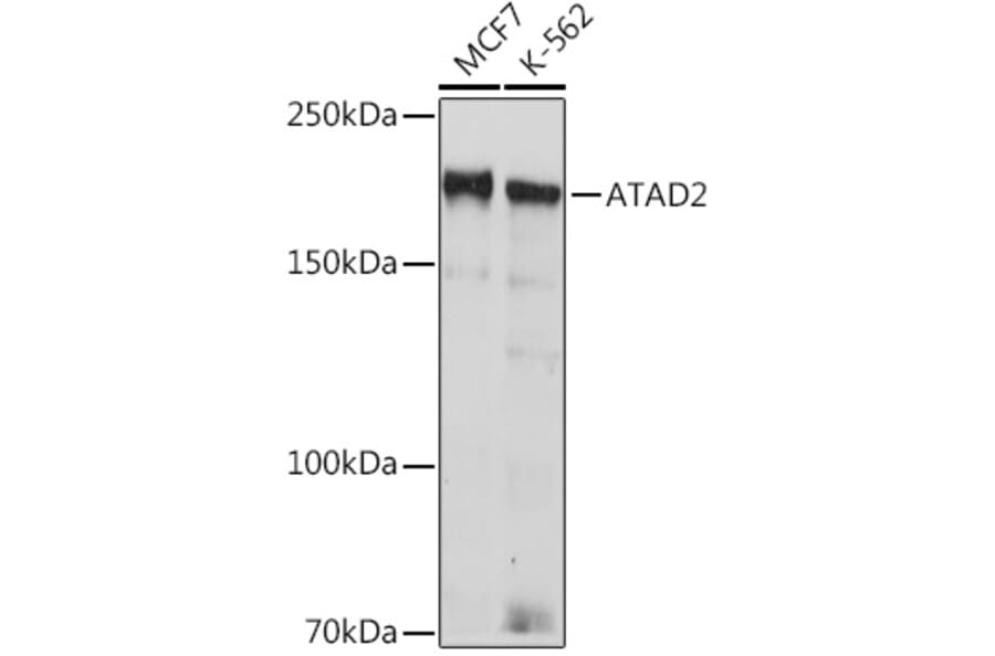 Western Blot - Anti-ATAD2 Antibody [ARC2317] (A307994) - Antibodies.com