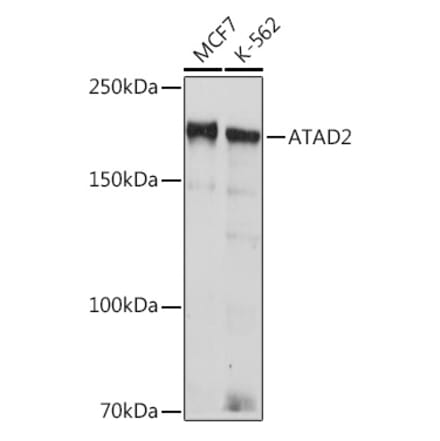 Western Blot - Anti-ATAD2 Antibody [ARC2317] (A307994) - Antibodies.com