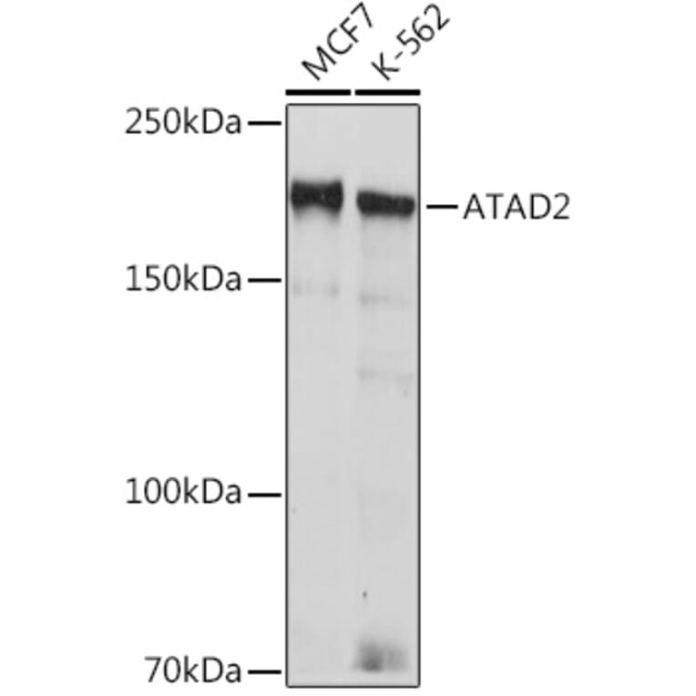 Western Blot - Anti-ATAD2 Antibody [ARC2317] (A307994) - Antibodies.com