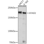 Western Blot - Anti-ATAD2 Antibody [ARC2317] (A307994) - Antibodies.com